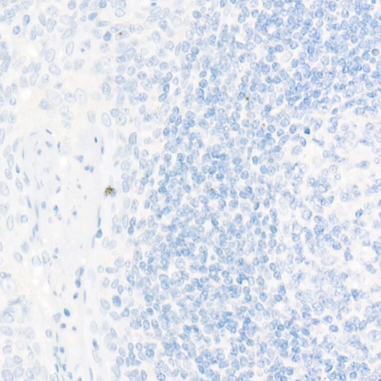 Immunohistochemistry - Anti-TTF1 Antibody [ARC51284] (A306550) - Antibodies.com