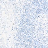 Immunohistochemistry - Anti-TTF1 Antibody [ARC51284] (A306550) - Antibodies.com