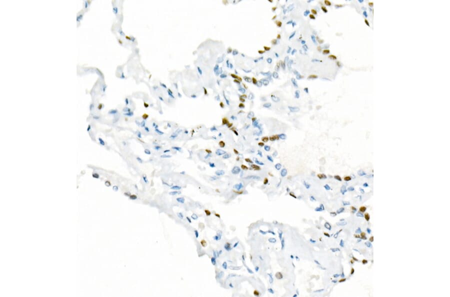 Immunohistochemistry - Anti-TTF1 Antibody [ARC51284] (A306550) - Antibodies.com