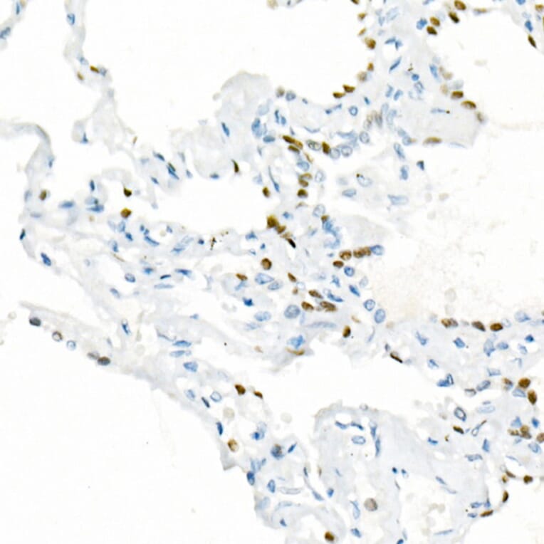 Immunohistochemistry - Anti-TTF1 Antibody [ARC51284] (A306550) - Antibodies.com