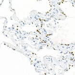 Immunohistochemistry - Anti-TTF1 Antibody [ARC51284] (A306550) - Antibodies.com