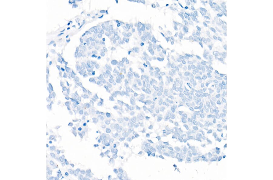 Immunohistochemistry - Anti-TTF1 Antibody [ARC51284] (A306550) - Antibodies.com