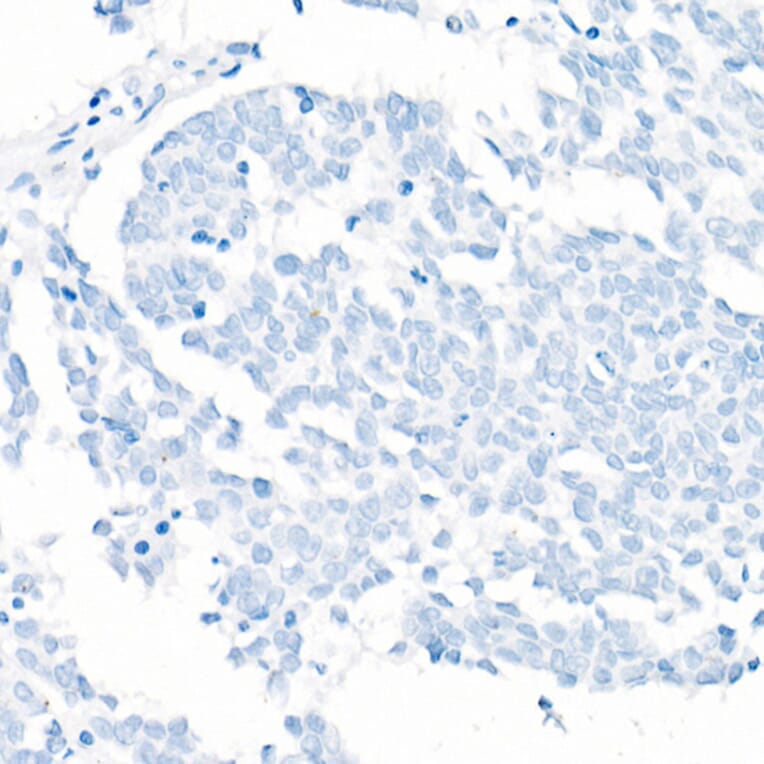 Immunohistochemistry - Anti-TTF1 Antibody [ARC51284] (A306550) - Antibodies.com