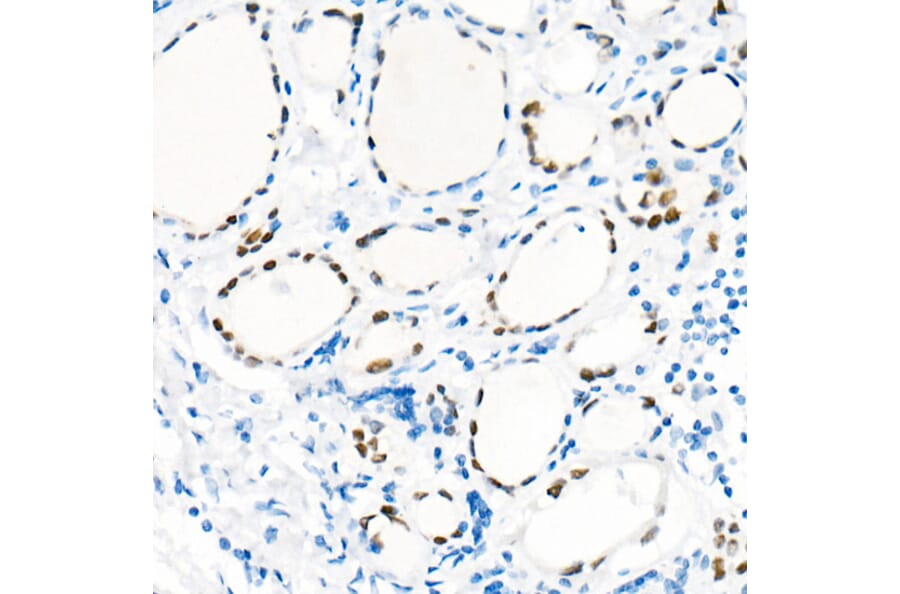 Immunohistochemistry - Anti-TTF1 Antibody [ARC51284] (A306550) - Antibodies.com