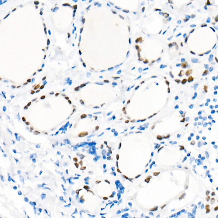 Immunohistochemistry - Anti-TTF1 Antibody [ARC51284] (A306550) - Antibodies.com