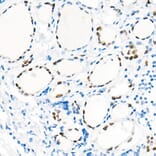 Immunohistochemistry - Anti-TTF1 Antibody [ARC51284] (A306550) - Antibodies.com