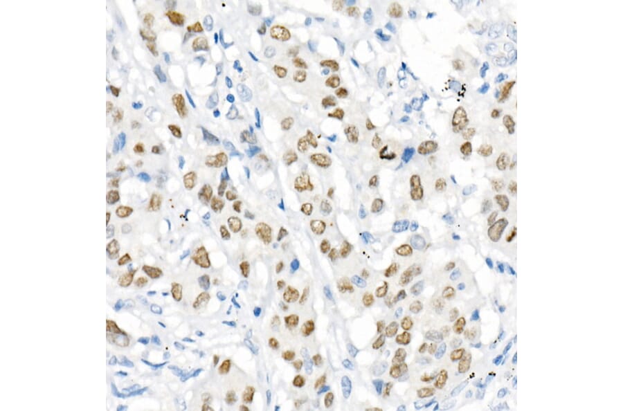 Immunohistochemistry - Anti-TTF1 Antibody [ARC51284] (A306550) - Antibodies.com
