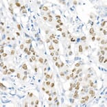 Immunohistochemistry - Anti-TTF1 Antibody [ARC51284] (A306550) - Antibodies.com