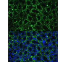 Immunofluorescence - Anti-TBCE Antibody (A306551) - Antibodies.com