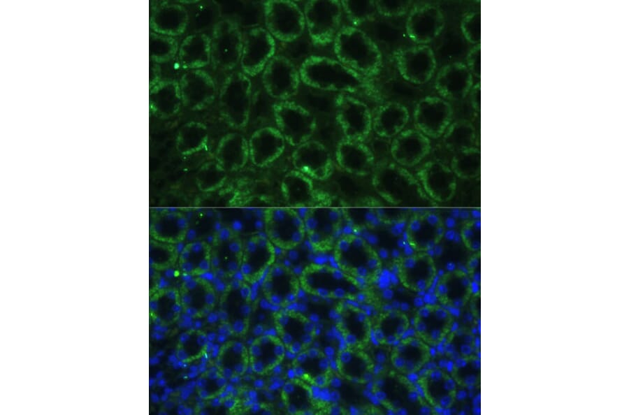 Immunofluorescence - Anti-TBCE Antibody (A306551) - Antibodies.com