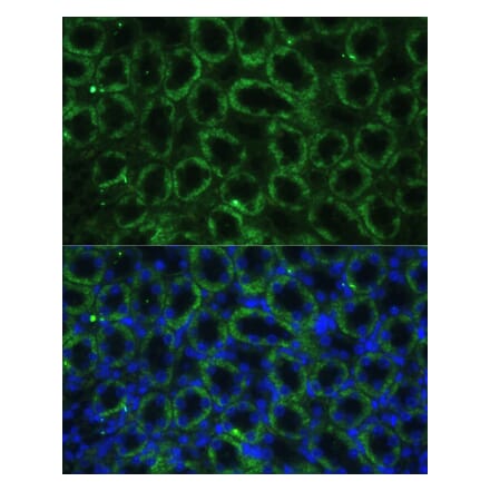 Immunofluorescence - Anti-TBCE Antibody (A306551) - Antibodies.com