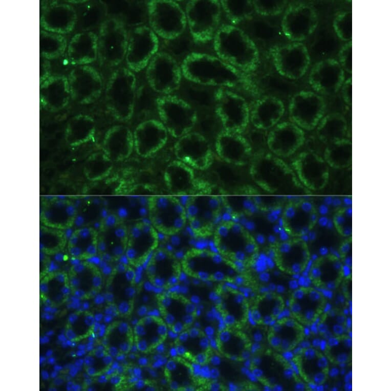 Immunofluorescence - Anti-TBCE Antibody (A306551) - Antibodies.com