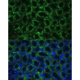 Immunofluorescence - Anti-TBCE Antibody (A306551) - Antibodies.com