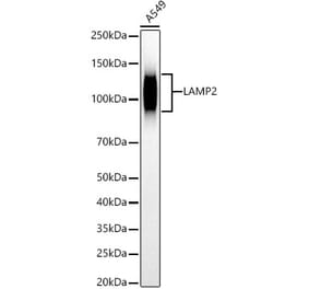 Western Blot - Anti-LAMP2 Antibody [ARC54762] (A306552) - Antibodies.com