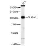 Western Blot - Anti-AFG2 Antibody (A306554) - Antibodies.com