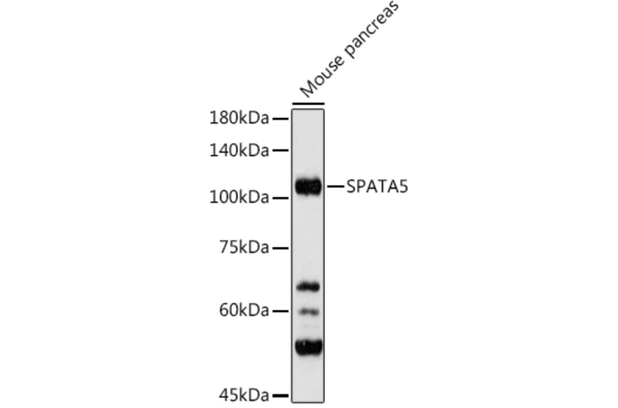 Western Blot - Anti-AFG2 Antibody (A306554) - Antibodies.com