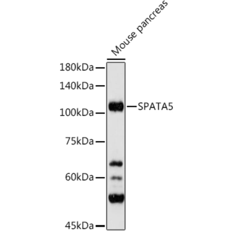 Western Blot - Anti-AFG2 Antibody (A306554) - Antibodies.com