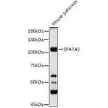 Western Blot - Anti-AFG2 Antibody (A306554) - Antibodies.com