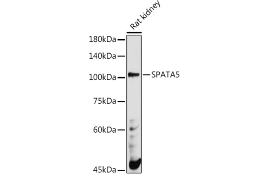 Western Blot - Anti-AFG2 Antibody (A306554) - Antibodies.com