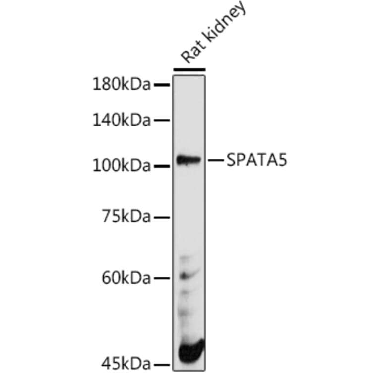 Western Blot - Anti-AFG2 Antibody (A306554) - Antibodies.com