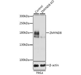 Western Blot - Anti-ZMYND8 Antibody (A306555) - Antibodies.com