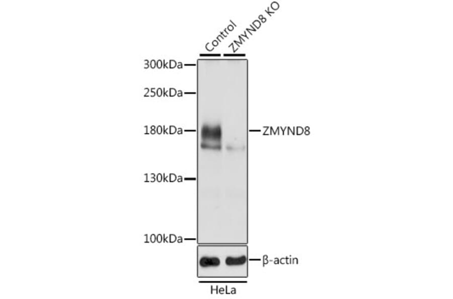 Western Blot - Anti-ZMYND8 Antibody (A306555) - Antibodies.com
