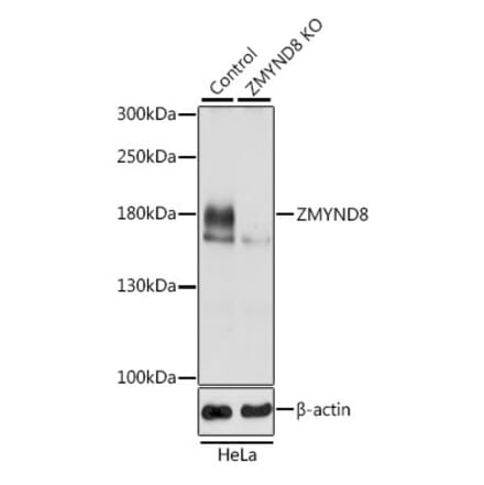 Western Blot - Anti-ZMYND8 Antibody (A306555) - Antibodies.com