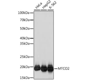 Western Blot - Anti-MTCO2 Antibody [ARC0844] (A306556) - Antibodies.com