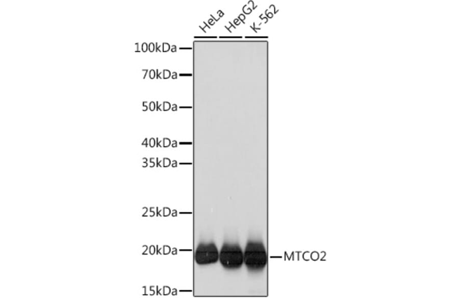 Western Blot - Anti-MTCO2 Antibody [ARC0844] (A306556) - Antibodies.com