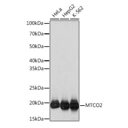 Western Blot - Anti-MTCO2 Antibody [ARC0844] (A306556) - Antibodies.com