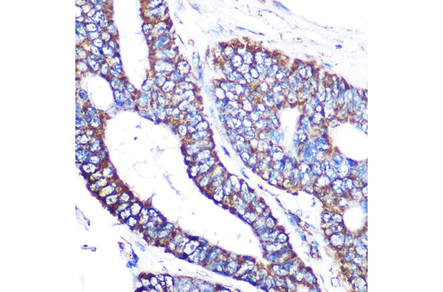 Immunohistochemistry - Anti-MTCO2 Antibody [ARC0844] (A306556) - Antibodies.com