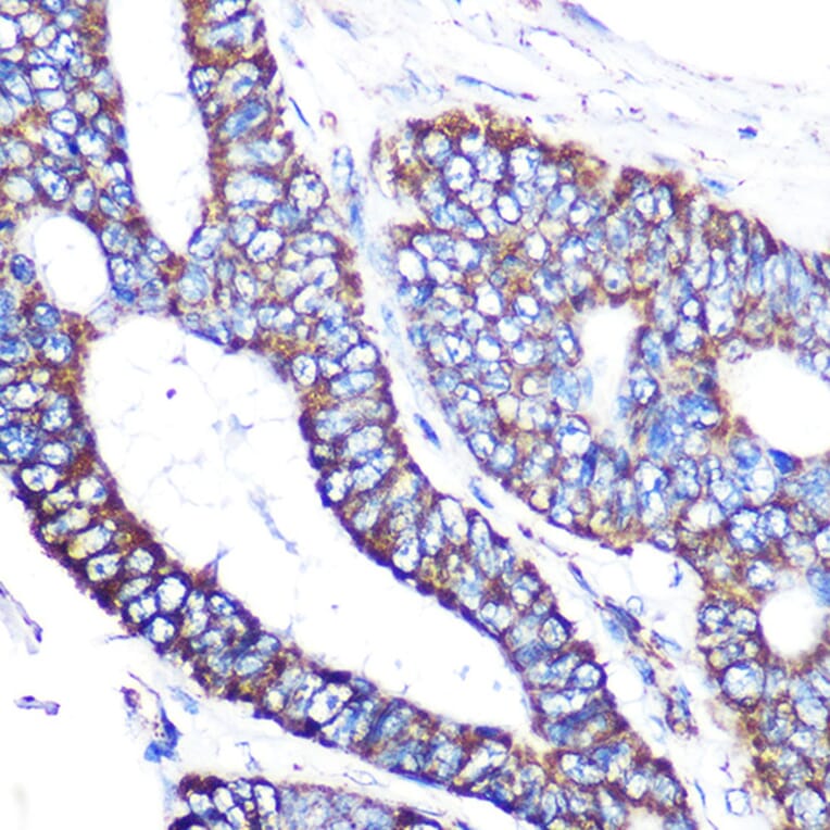 Immunohistochemistry - Anti-MTCO2 Antibody [ARC0844] (A306556) - Antibodies.com