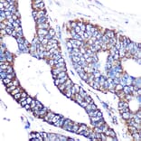 Immunohistochemistry - Anti-MTCO2 Antibody [ARC0844] (A306556) - Antibodies.com