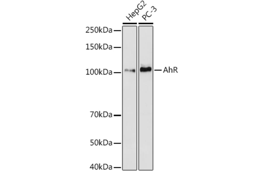 Western Blot - Anti-Aryl hydrocarbon Receptor Antibody [ARC53212] (A306557) - Antibodies.com