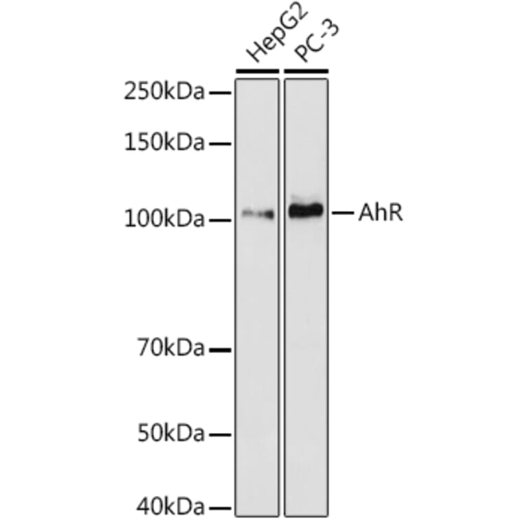 Western Blot - Anti-Aryl hydrocarbon Receptor Antibody [ARC53212] (A306557) - Antibodies.com