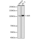 Western Blot - Anti-Aryl hydrocarbon Receptor Antibody [ARC53212] (A306557) - Antibodies.com