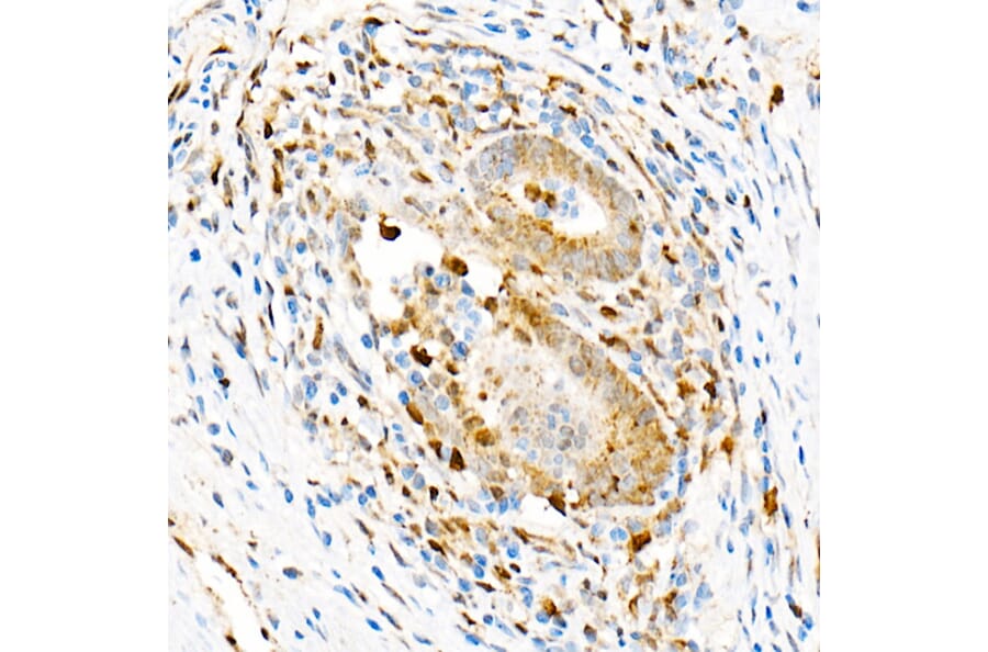 Immunohistochemistry - Anti-Aryl hydrocarbon Receptor Antibody [ARC53212] (A306557) - Antibodies.com
