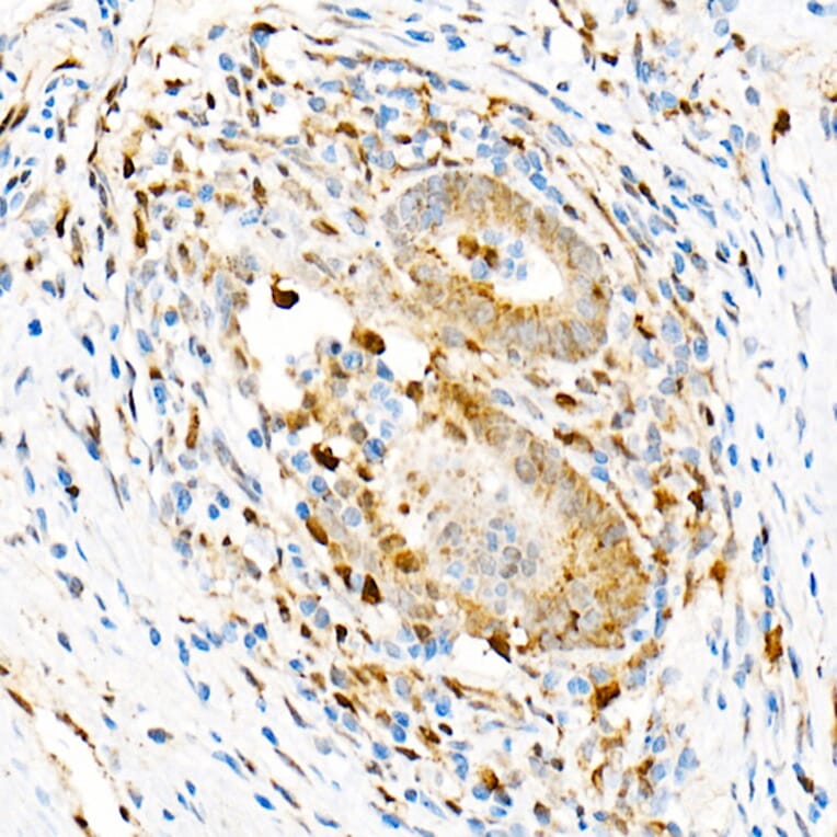 Immunohistochemistry - Anti-Aryl hydrocarbon Receptor Antibody [ARC53212] (A306557) - Antibodies.com