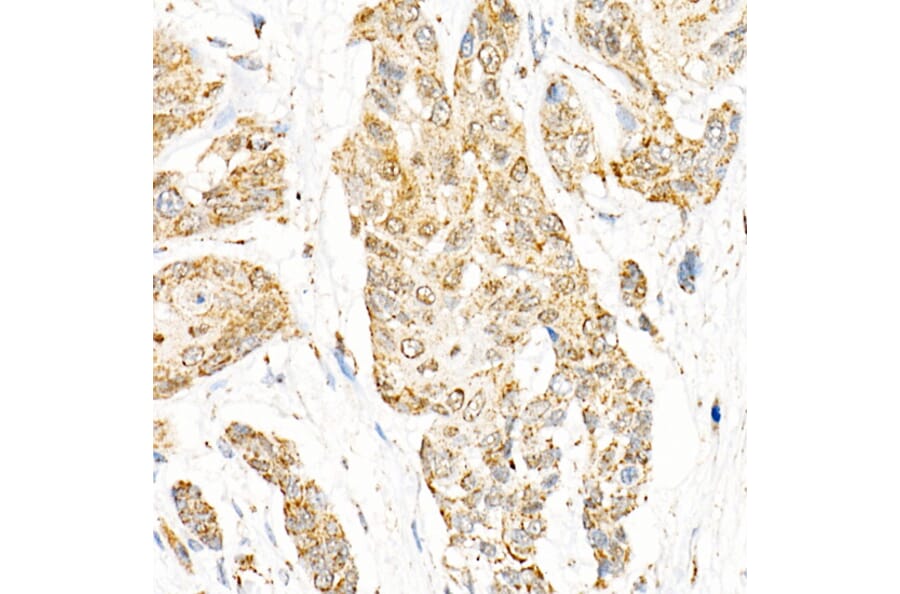 Immunohistochemistry - Anti-Aryl hydrocarbon Receptor Antibody [ARC53212] (A306557) - Antibodies.com