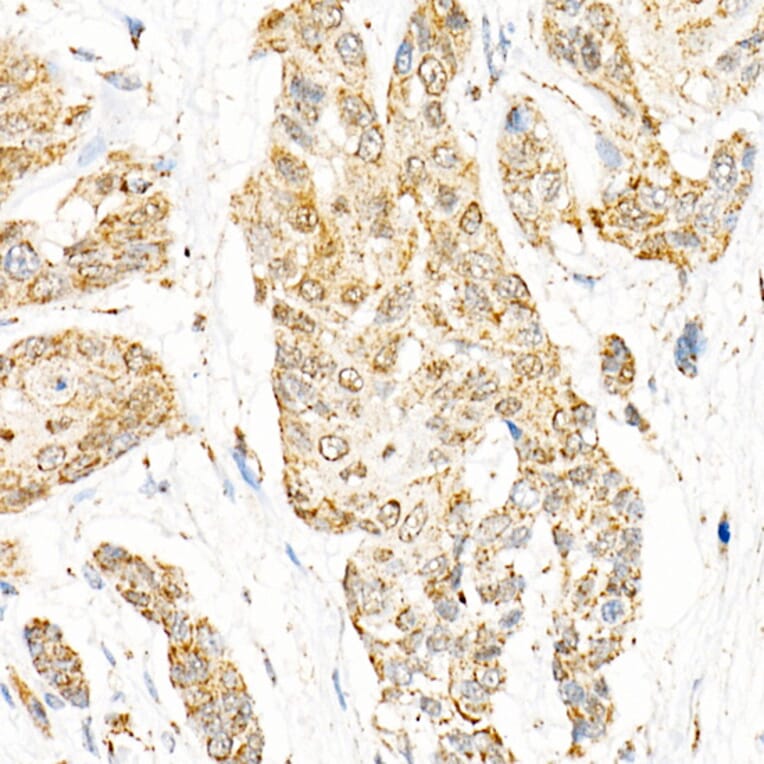 Immunohistochemistry - Anti-Aryl hydrocarbon Receptor Antibody [ARC53212] (A306557) - Antibodies.com