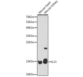 Western Blot - Anti-IL-15 Antibody (A306559) - Antibodies.com