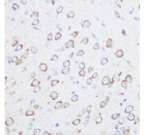 Immunohistochemistry - Anti-NG2 Antibody (A306561) - Antibodies.com