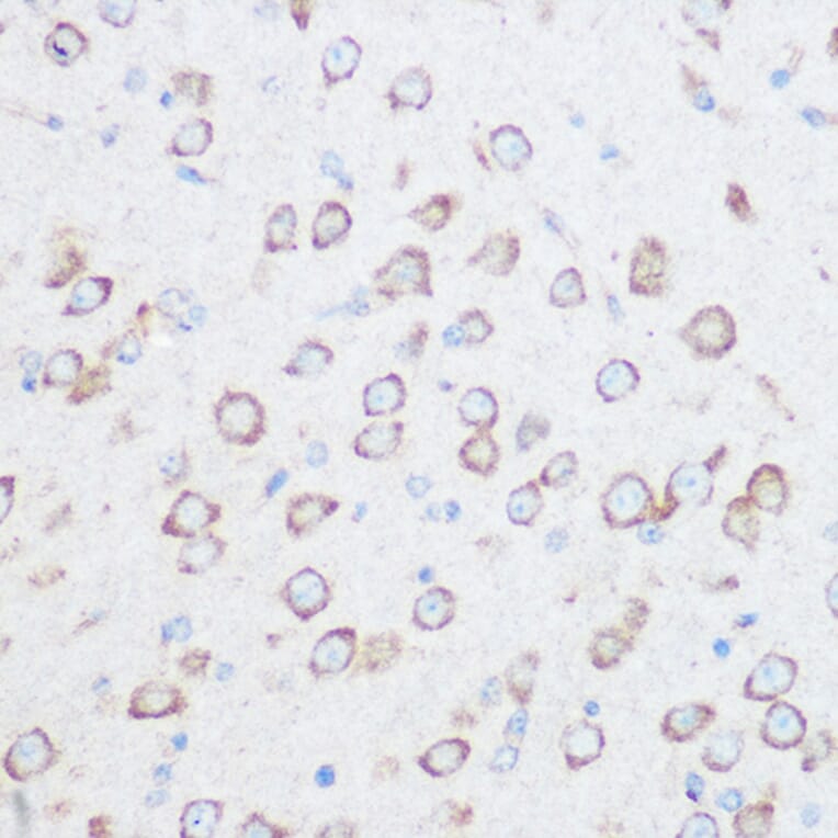 Immunohistochemistry - Anti-NG2 Antibody (A306561) - Antibodies.com