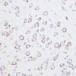 Immunohistochemistry - Anti-NG2 Antibody (A306561) - Antibodies.com