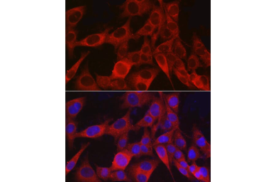 Immunofluorescence - Anti-NG2 Antibody (A306561) - Antibodies.com