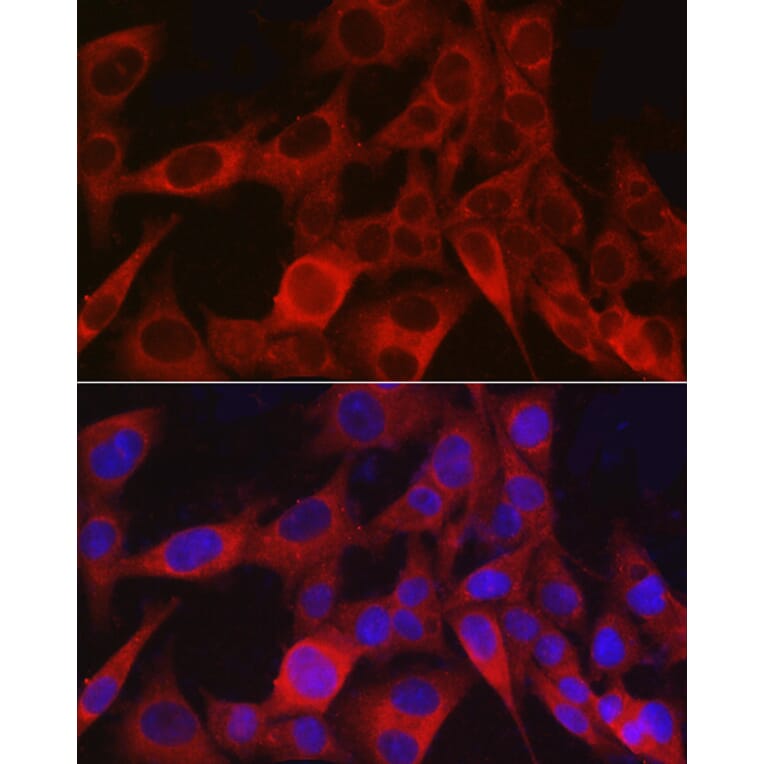 Immunofluorescence - Anti-NG2 Antibody (A306561) - Antibodies.com