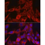Immunofluorescence - Anti-NG2 Antibody (A306561) - Antibodies.com