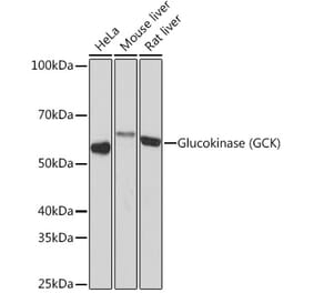 Western Blot - Anti-Glucokinase Antibody [ARC1226] (A306563) - Antibodies.com