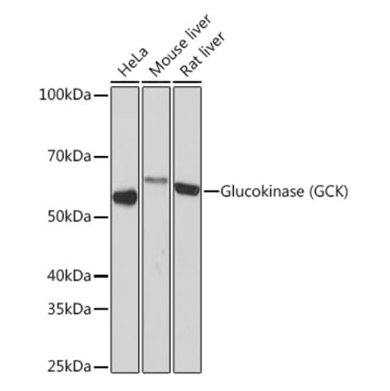 Western Blot - Anti-Glucokinase Antibody [ARC1226] (A306563) - Antibodies.com