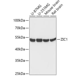 Western Blot - Anti-Zic1 Antibody (A306564) - Antibodies.com